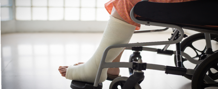 broken leg
