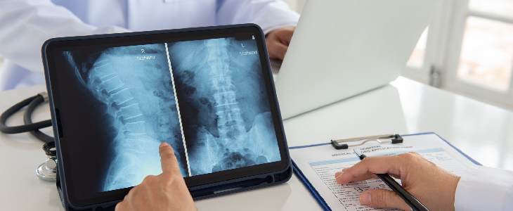 Doctor analyzing spine span to look for spinal cord injuries.