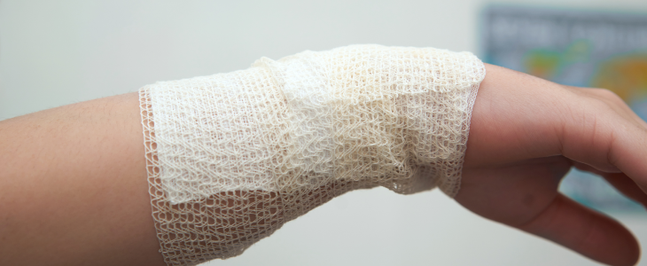 Woman with a bandage wrapped around a burn injury.