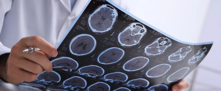 brain injury symptoms